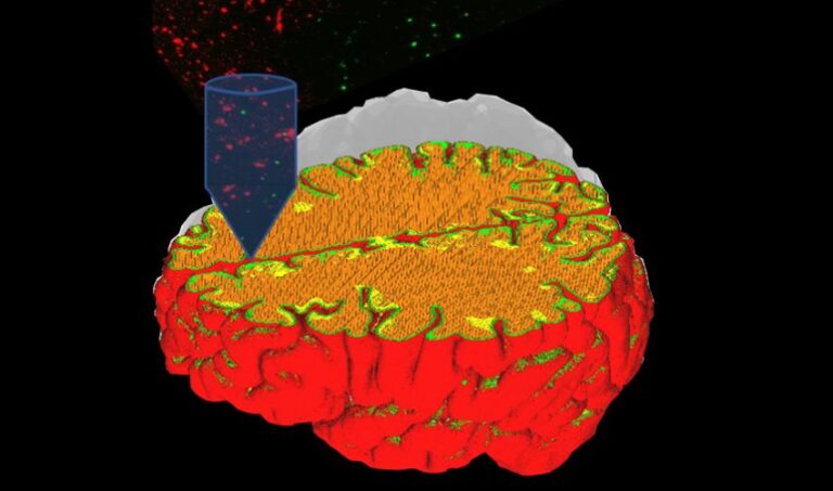 Malattie neuronali: come scoprirle con i tessuti in 3D