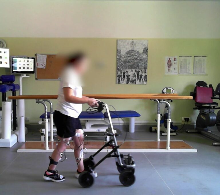 Un neurostimolatore midollare per camminare dopo una lesione spinale Un neurostimolatore midollare per camminare dopo una lesione spinale