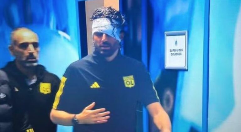 Follia a Marsiglia: sassi contro bus Lione, ferito Fabio Grosso