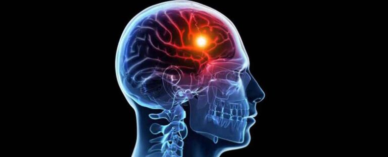 Ictus, al Garibaldi un’avanzata tecnologia unica in Italia