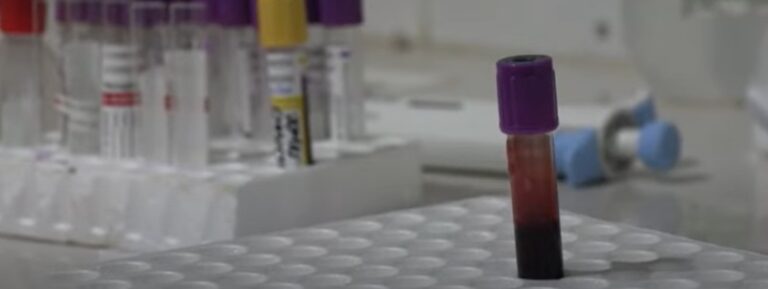Giornata contro l’Aids, ancora 1,3 milioni di contagi