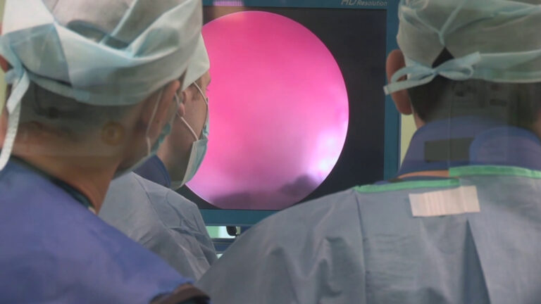 Tumore al polmone, i vantaggi della chirurgia robotica