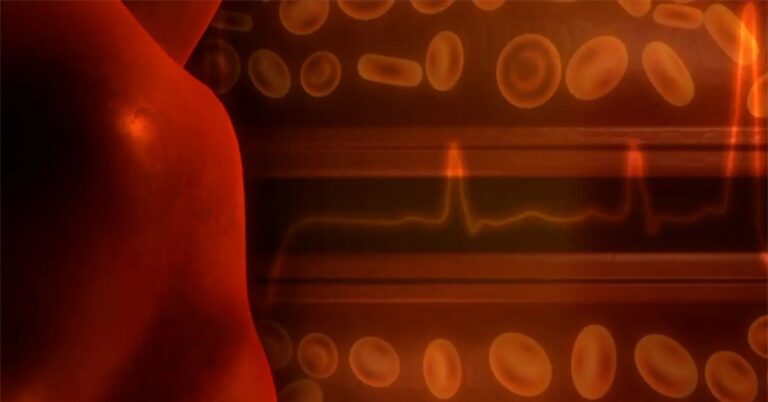 Cardiopatie nei bambini, ecco come riconoscerle