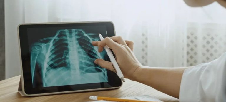 Patologie del torace, la diagnosi precoce è fondamentale