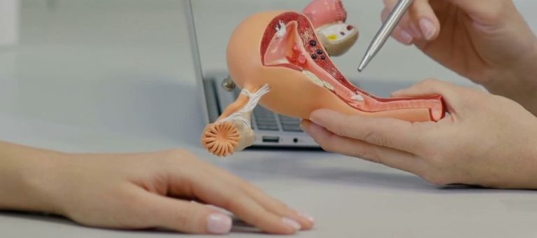 Comuni e quasi sempre benigni, come trattare i fibromi uterini