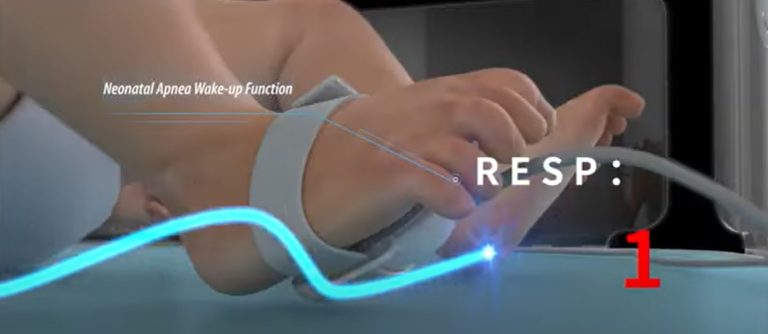 Isola neonatale donata al Ccpm Taormina: ecco la termoculla (VIDEO)