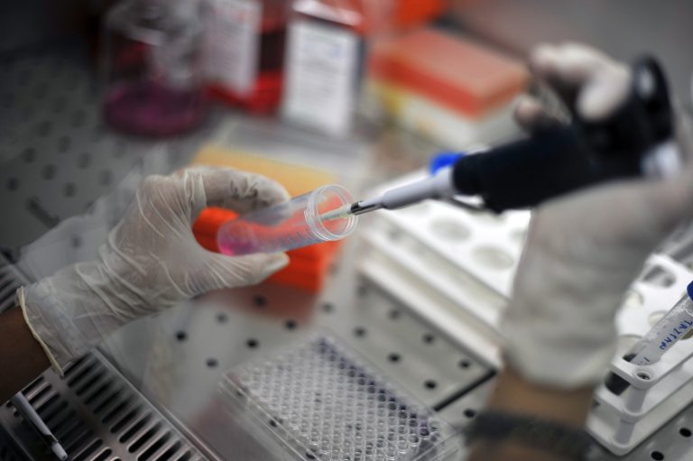 Scoperti codici del sistema immunitario per sospendere le cure da HIV