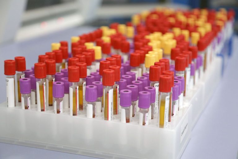 Botulino, Meo: (Artemisia Lab) “Attenzione alle conserve fatte in casa”