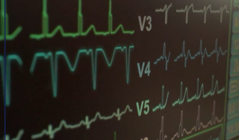 In Italia 100 mila casi di ictus ogni anno, prevenzione e cure fanno la differenza