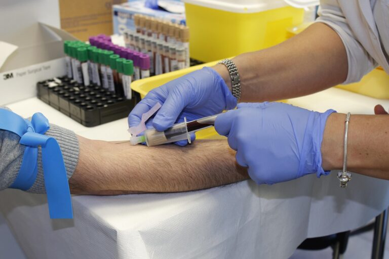 Donazione del sangue, Italia autosufficiente. Ma sul plasma servono passi avanti