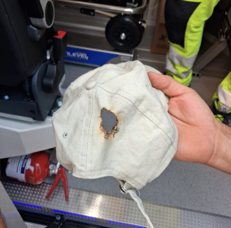 Taormina choc, ecco il cappello che ha protetto il bambino colpito da un cavo elettrico